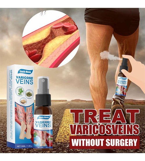 Varicose Vein Spray Vasculitis Phlebitis Relief Cream Spider Legs Treatment Smoothing Blood Vessel Redness Herbal Body Care 30ml